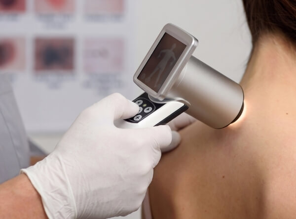 Clinician using a dermatoscope to examine a skin lesion on a patient’s shoulder